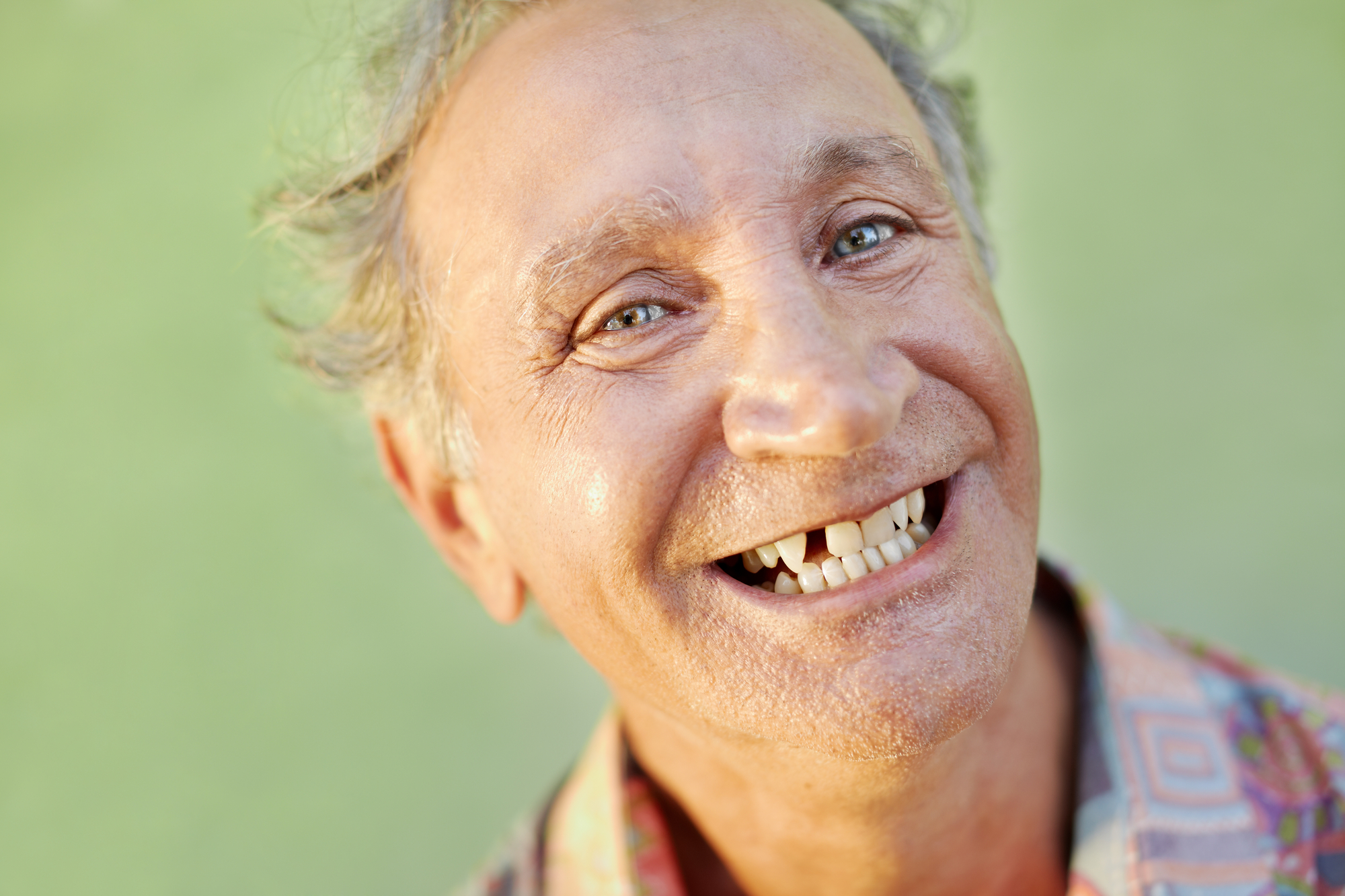 How Missing Teeth Affect Your Oral Health